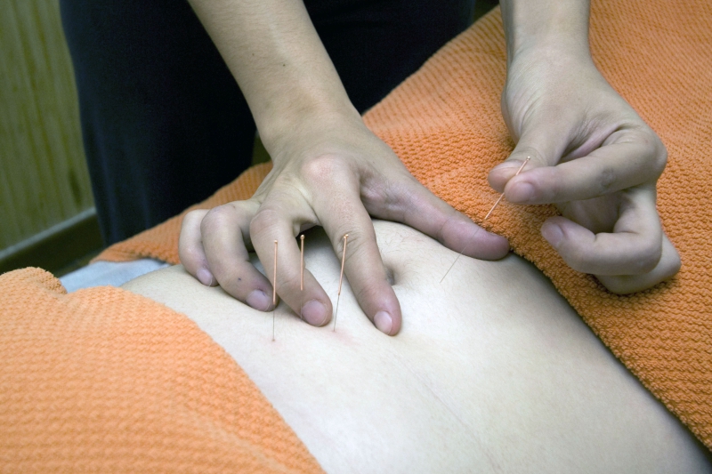 osteopathe-CHATEAUNEUF GRASSE-min_acupuncture-4175625